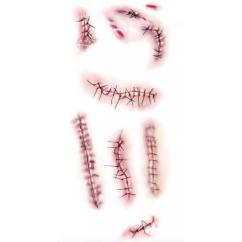 Trauma Temp - Point De Suture